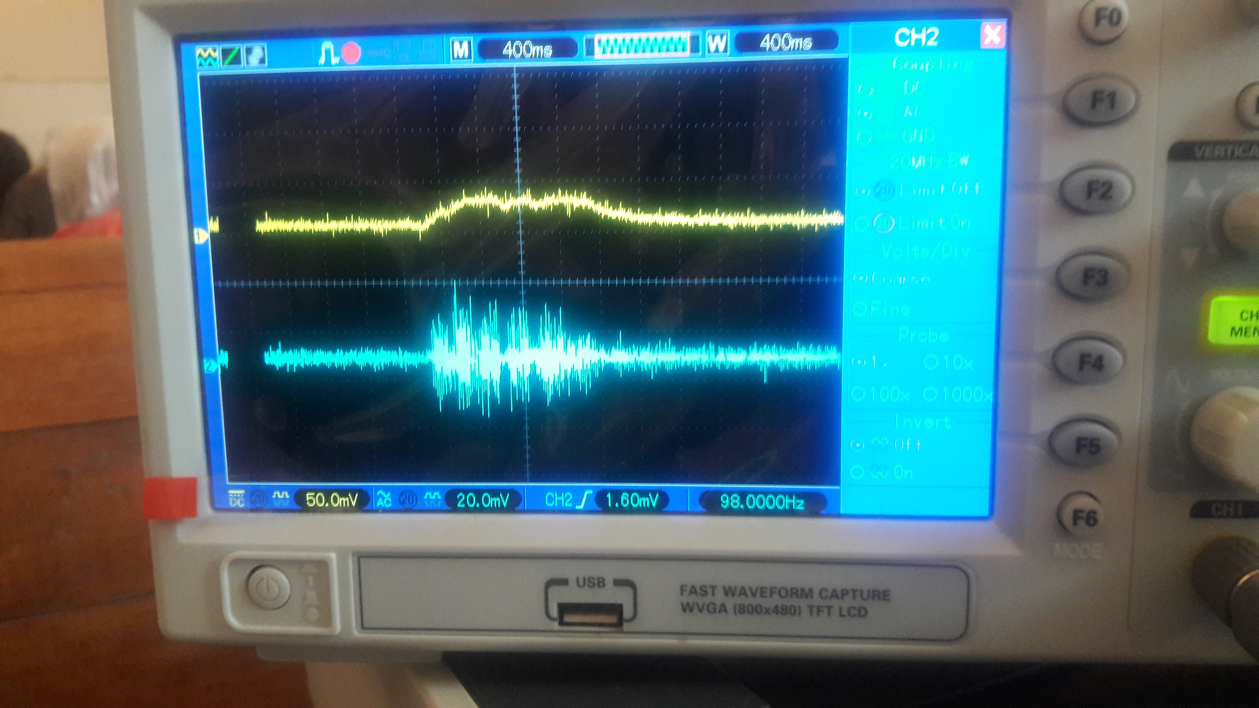 Title: Real-time Electromyography (EMG) Signal Visualization