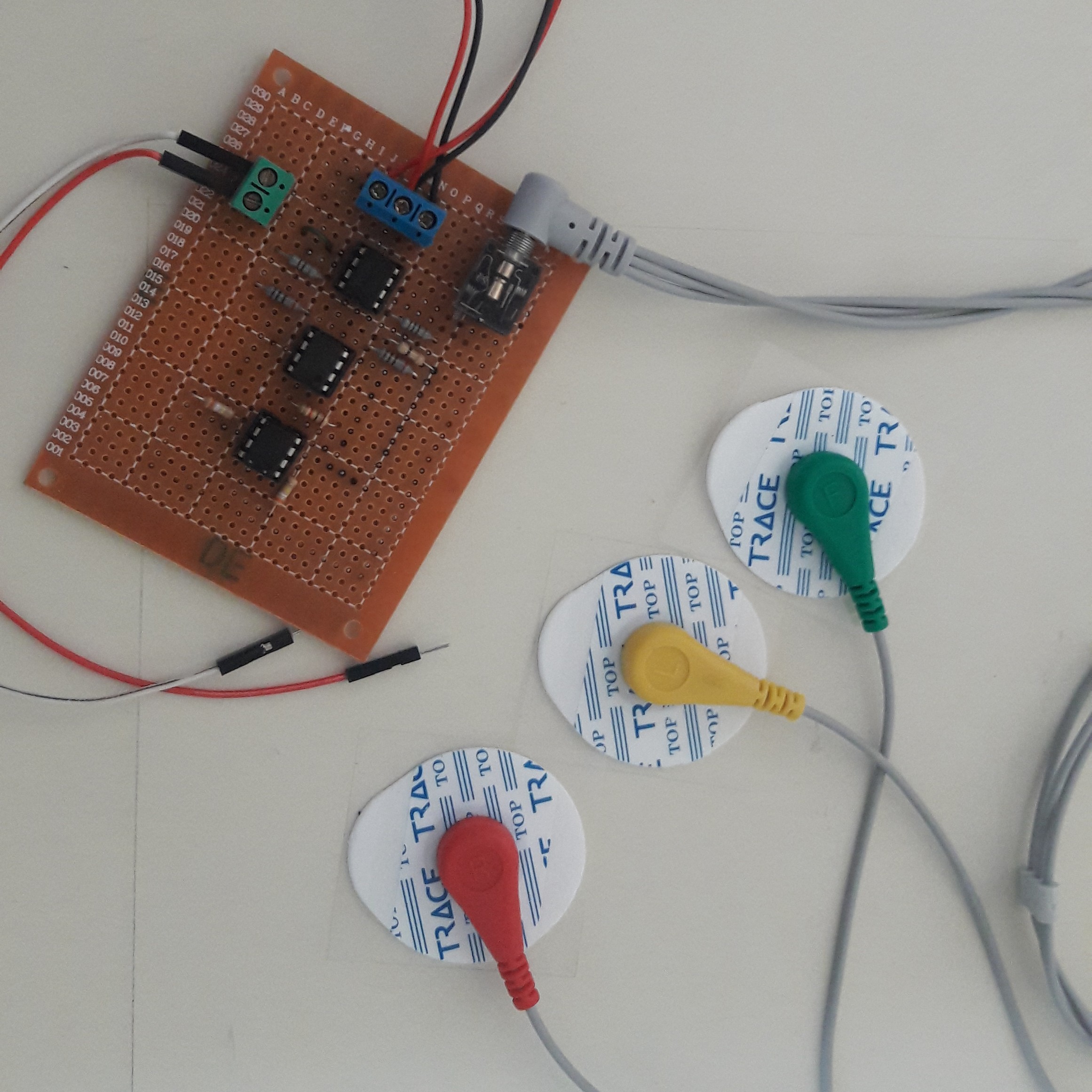 Custom EMG Signal Conditioning Circuit – Prototype Phase